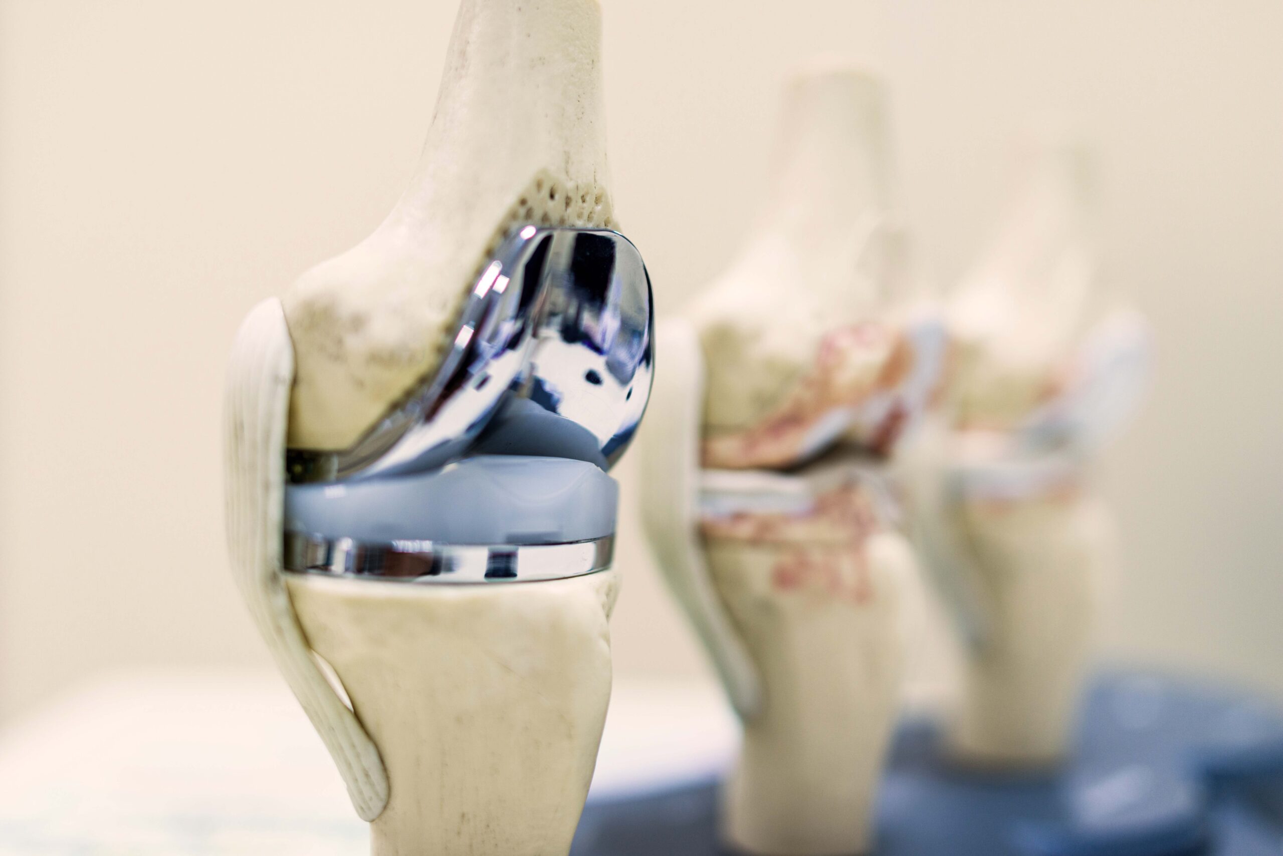 Knee,Joint,Model,Or,Mock-up,With,Knee,Replacement,Prosthesis,In