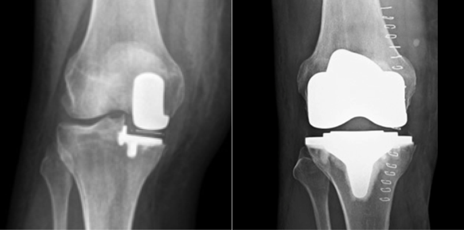 LLS_Webseite_OrthoTrauma_Knie